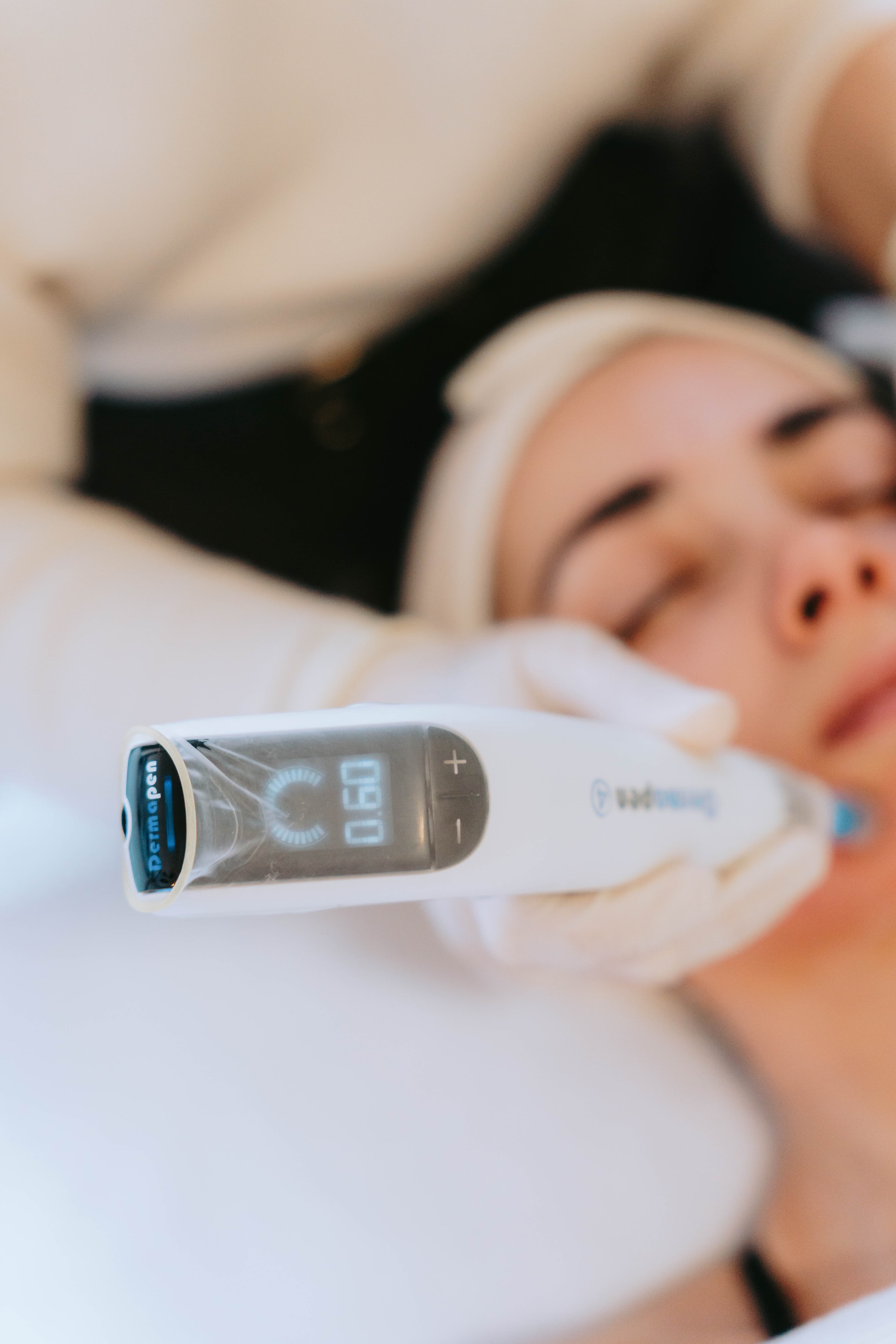 Microagulhamento Facial